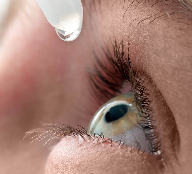 Dry eye disease common during the perimenopause